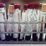 Diagnostik-Branche verliert an Glanz