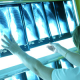 Kombitherapien sollen gegen Krebs helfen