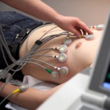 Novartis muss die Frequenz erhöhen