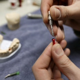 Straumann gehen die Superlative aus