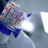 Hot Corner: Santheras neuer Versuch