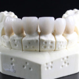 Straumann bereit für den chinesischen Markt