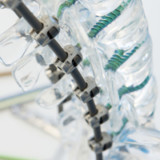 Positive Kommentare beflügeln Medacta nur kurz