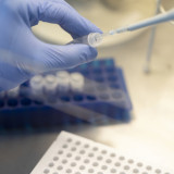 Molecular Partners will Titel in den USA listen lassen