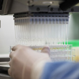 BB Biotech mit höherem Verlust