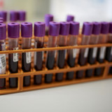 Newron erzielt Erfolg in den USA