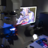 Molecular Partners' neuartiges Molekül wirkt