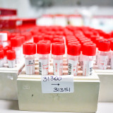 Roche: keine Lieferprobleme bei Coronavirustests