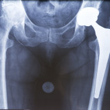 Zäsur für die Medtech-Branche