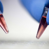 Relief-Partner NRx legt weitere Daten zu Coronakandidaten vor