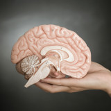 Alzheimer-Werte sind nach Biogen-Erfolg im Aufwind