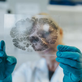 Idorsia erhält Zulassung in Japan